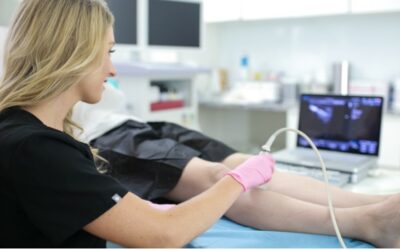 What is a Varicose Vein Specialist Called? We Answer Your Vein Treatment Questions
