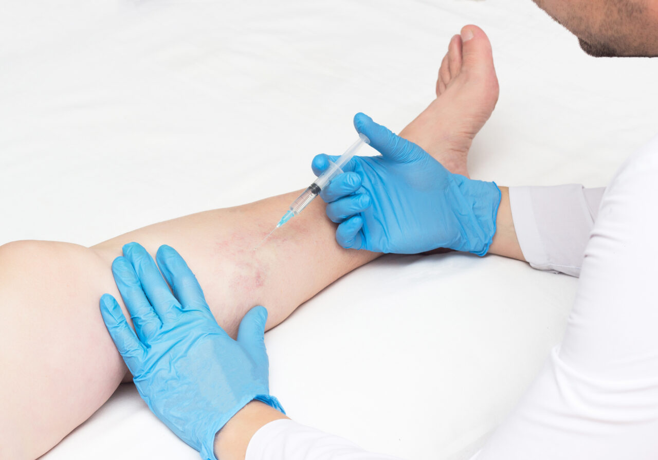 dummy-image-m What is a varicose vein specialist called? What does a dermatologist do for varicose veins? When should you worry about varicose veins? We answer your questions about varicose veins in TX.