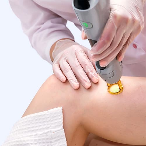 VIP-TREATMENTS_SPIDER-VEINS_TREATMENTS_img2@2x