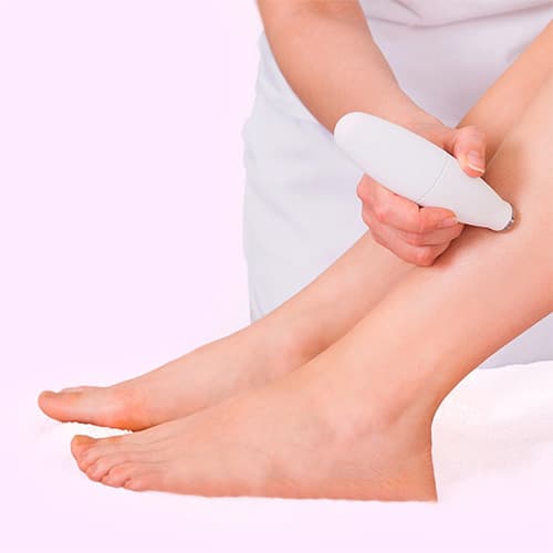 VIP-TREATMENTS_SPIDER-VEINS_TREATMENTS_img4@2x